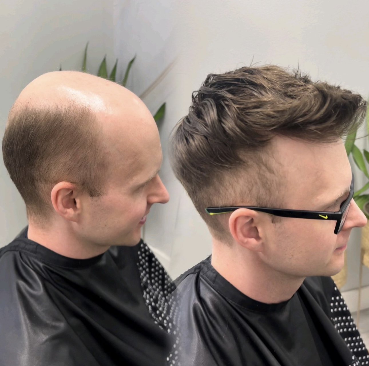 Before and after hair system styling example